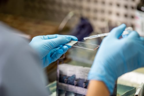 Staining of a Pap Smear Slide