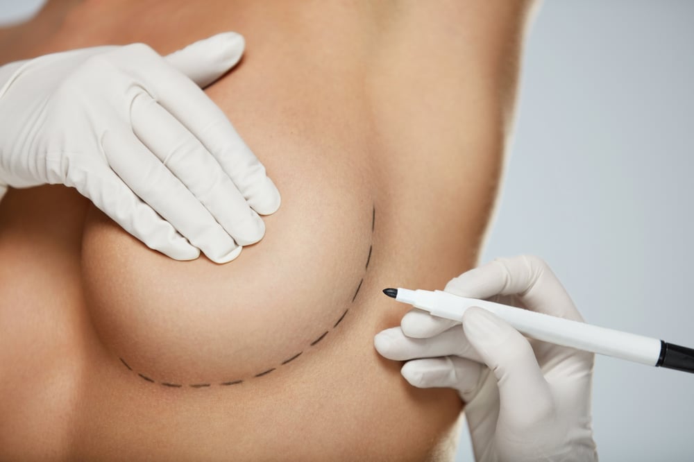 Breast Enhancement Consultation: Garden Plastic Surgery Center