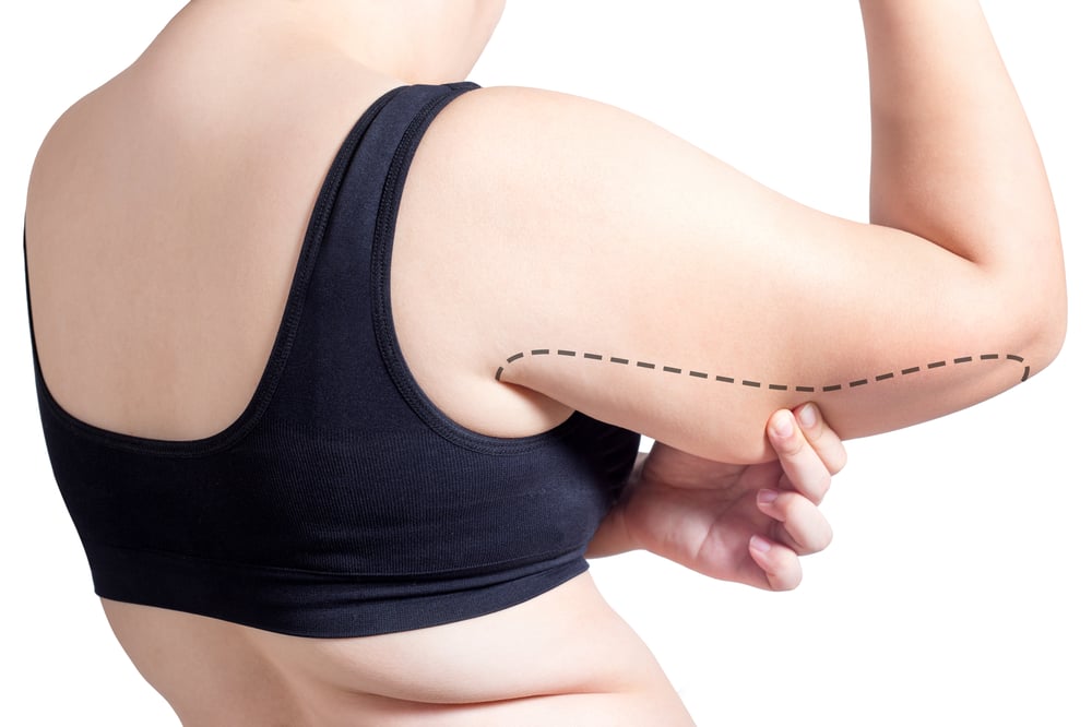 Liposuction Consultation: Garden Plastic Surgery Center