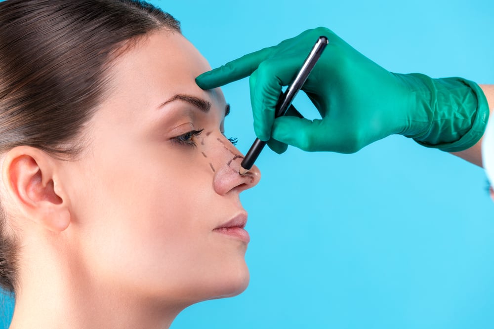 Rhinoplasty Drawing - What to Expect