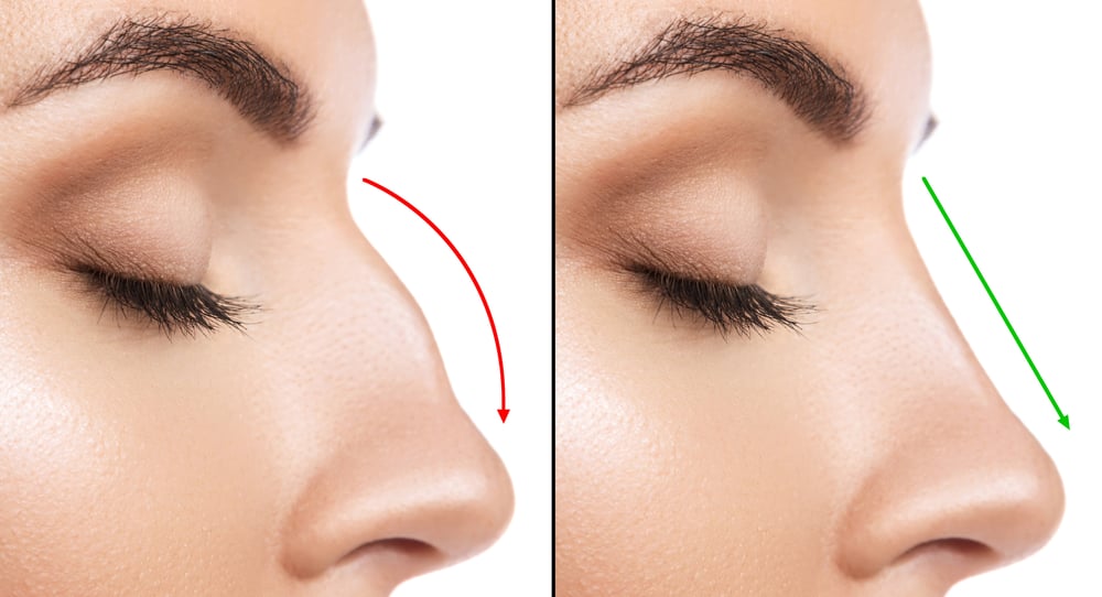 Rhinoplasty Services Center: Garden Plastic Surgery Center