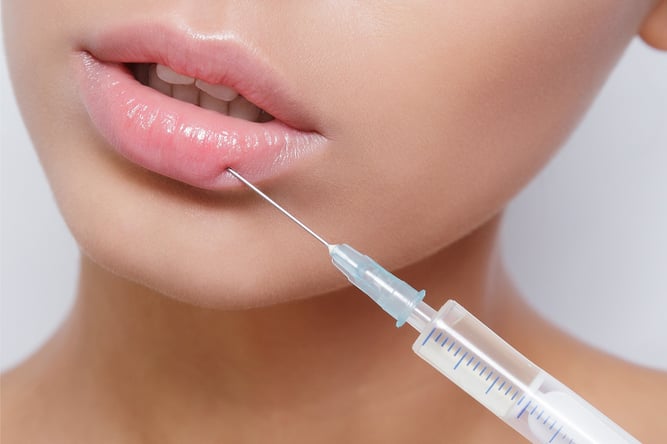 Lip Fillers Service