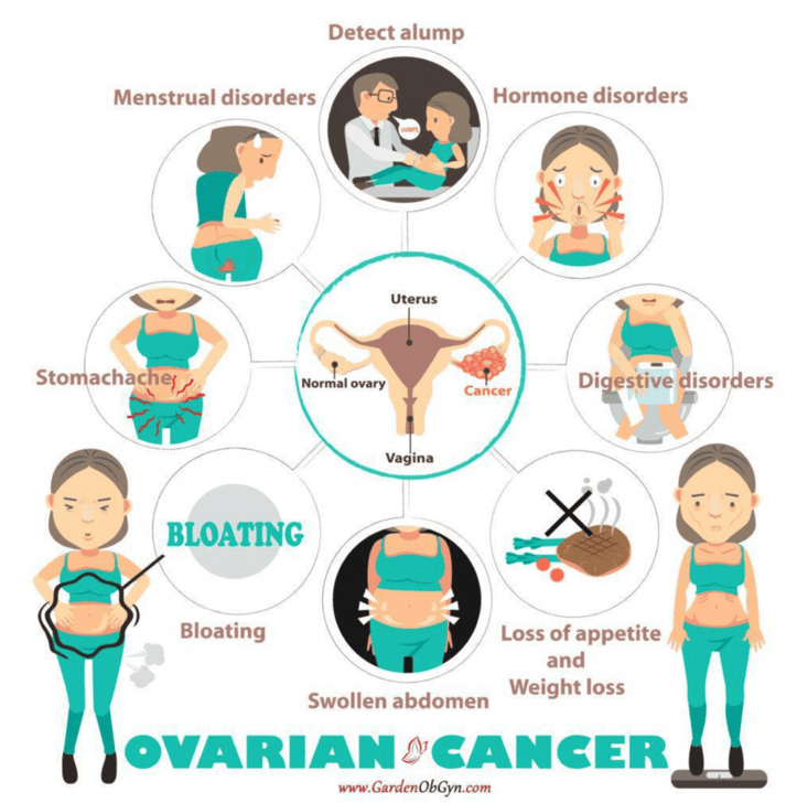 Ovarian Cancer: The Importance Of Recognizing The Symptoms