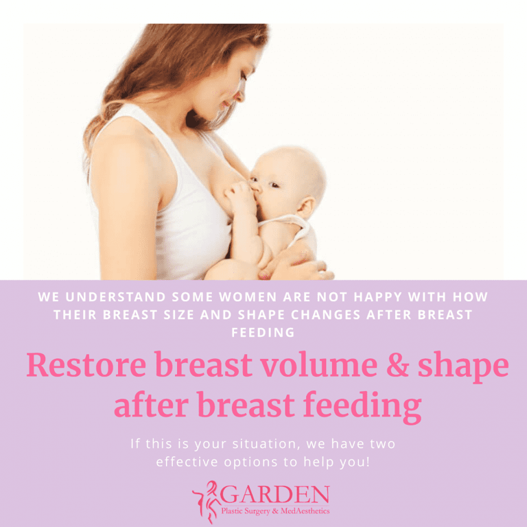 Breast Volume Options After Breast Feeding