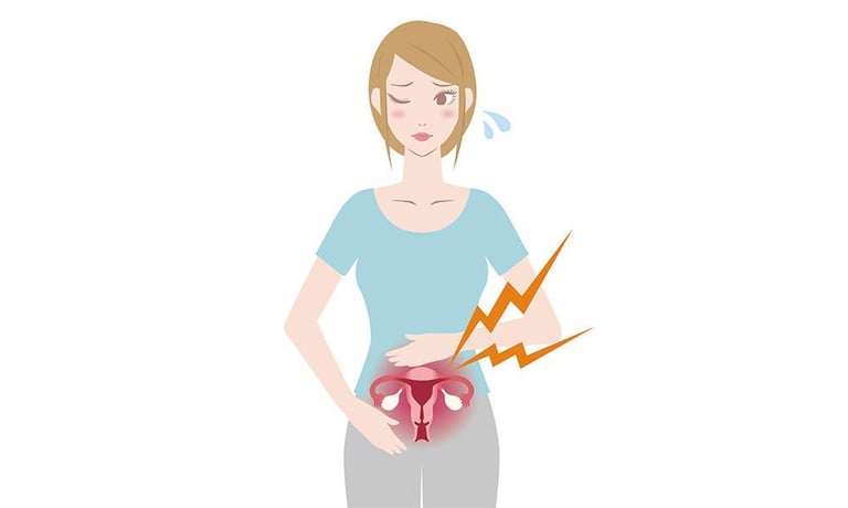 Endometriosis What You Need To Know!