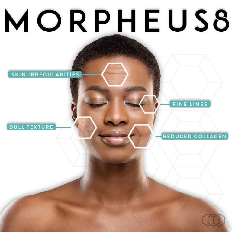 Unlock Radiant Skin: Elevate Your Beauty with Morpheus8